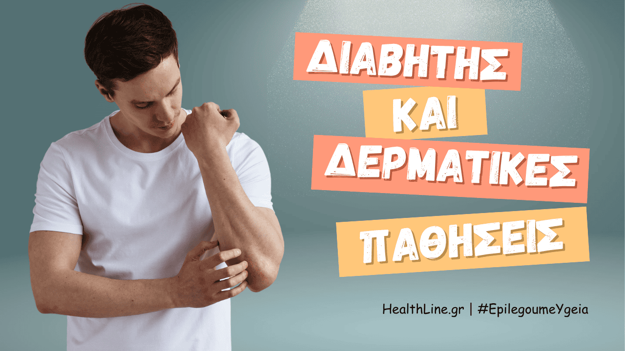 διαβήτης και δερματικές παθήσεις - Φιρούζα Κουρτίδου Παθολόγος Διαβητολόγος